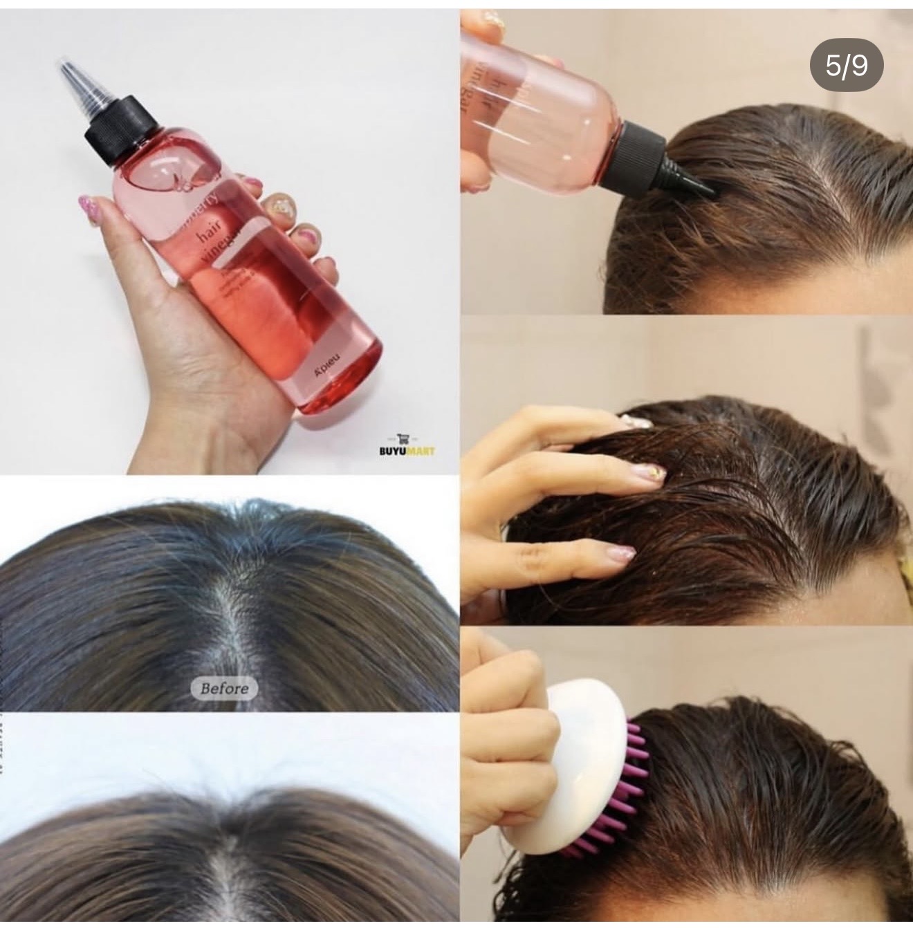 خل التوت للفروه لعلاج القشره ⬇️